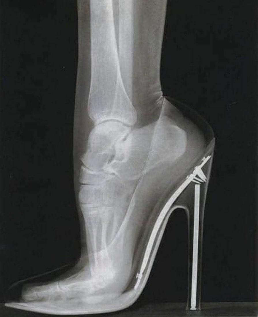 L'ascension vertigineuse : une brève histoire des talons hauts